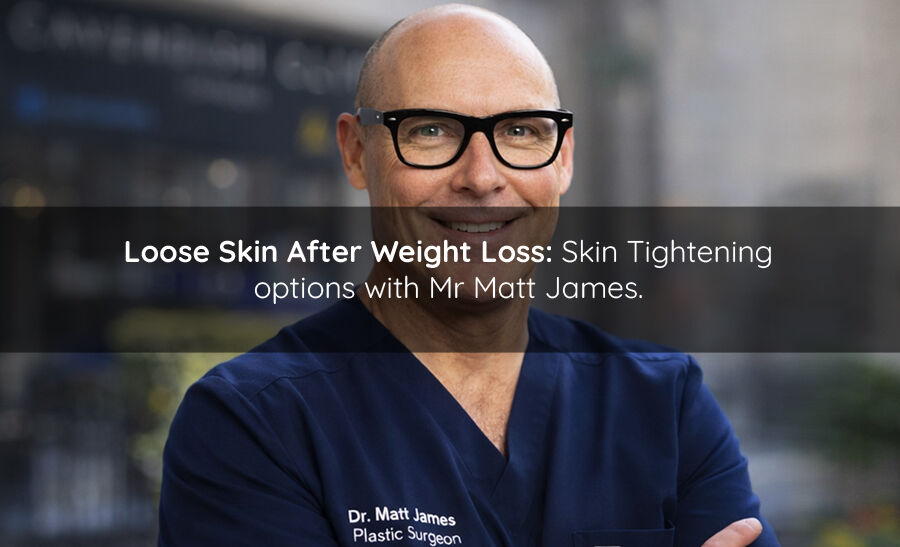 Loose Skin After Weight Loss: Skin Tightening options with Mr Matt James