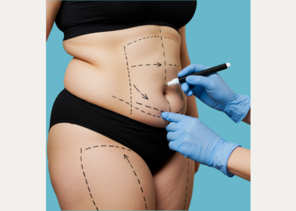 GLP-1 Weight Loss Boom & Rise in Tummy Tucks Explained